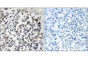 Immunohistochemistry analysis of paraffin-embedded human lymph node tissue, using CLIC4 Antibody. (CLIC4 antibody  (AA 1-50))