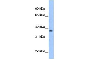 ST3GAL2 antibody used at 1 ug/ml to detect target protein.