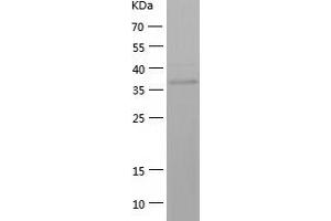 Western Blotting (WB) image for Aldo-keto Reductase Family 1 Member C4 (AKR1C4) (AA 1-343) protein (His tag) (ABIN7285510) (AKR1C4 Protein (AA 1-343) (His tag))