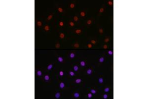 Immunofluorescence (IF) image for anti-High Mobility Group Box 1 (HMGB1) (acLys29) antibody (ABIN7267647)