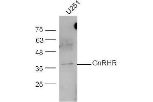 U251 lysates probed with GnRHR Polyclonal Antibody, unconjugated  at 1:300 overnight at 4°C followed by a conjugated secondary antibody at 1:10000 for 60 minutes at 37°C. (GNRHR antibody  (AA 201-328))