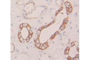 Figure. (Mesothelin antibody  (AA 400-615))