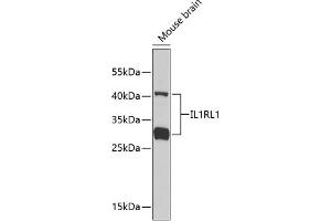Western blot analysis of extracts of mouse brain, using IL1RL1 antibody . (IL1RL1 antibody  (AA 19-328))