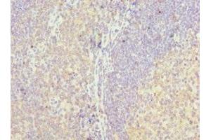Immunohistochemistry of paraffin-embedded human tonsil tissue using ABIN7158640 at dilution of 1:100 (LY86 antibody  (AA 21-162))