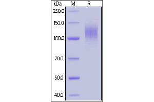 SDS-PAGE (SDS) image for SARS-CoV-2 Spike S1 protein (His tag) (ABIN6952427)