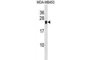 Western Blotting (WB) image for anti-Cysteine-Rich Protein 2 (CRIP2) antibody (ABIN2998781)