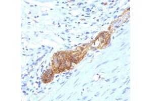 Formalin-fixed, paraffin-embedded human colon stained with anti-CD56 antibody (SPM489) (Neurofilament antibody  (Extracellular Domain))