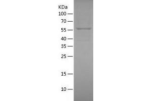 Western Blotting (WB) image for Polymerase (DNA Directed) kappa (POLK) (AA 1-560) protein (His tag) (ABIN7289233) (POLK Protein (AA 1-560) (His tag))