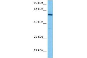 Host:  Mouse  Target Name:  DAB2  Sample Tissue:  Mouse Spleen  Antibody Dilution:  1ug/ml (DAB2 antibody  (N-Term))