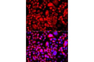 Immunofluorescence analysis of A549 cells using FASN antibody (ABIN5970172). (Fatty Acid Synthase antibody)