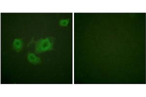 Immunofluorescence analysis of HuvEc cells, using Kir6. (KCNJ11 antibody  (pThr224))