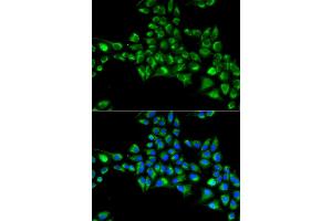 Immunofluorescence analysis of HeLa cell using CYGB antibody. (CYGB antibody)
