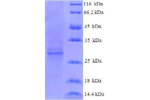 HEV ORF3 Protein (AA 1-114, full length) (His-SUMO Tag)