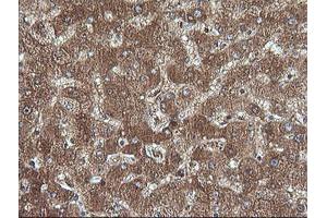 Image no. 1 for anti-Cancer/testis Antigen 1B (CTAG1B) antibody (ABIN1499896) (CTAG1B antibody)