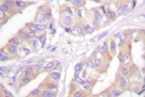 Image no. 2 for anti-V-Raf Murine Sarcoma 3611 Viral Oncogene Homolog (ARAF) antibody (ABIN271994) (ARAF antibody)