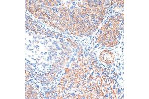 Immunohistochemistry of paraffin-embedded Rat ovary using TIMP2 antibody (ABIN7268483) at dilution of 1:100 (40x lens).