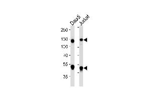 Western blot analysis of lysates from Daudi, Jurkat cell line (from left to right), using NFKB1 Antibody (ABIN1882050 and ABIN2843642). (NFKB1 antibody)