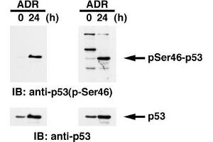 Western Blotting (WB) image for anti-Tumor Protein P53 (TP53) (pSer46) antibody (ABIN3201005)