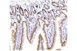 IHC analysis of PTBP1 using anti-PTBP1 antibody (ABIN7599450).