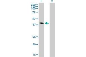 Western Blot analysis of CA12 expression in transfected 293T cell line by CA12 monoclonal antibody (M01), clone 1D4. (CA12 antibody  (AA 25-124))