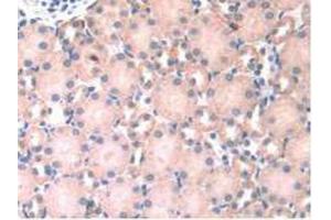 IHC-P analysis of Mouse Kidney Tissue, with DAB staining. (HPSE antibody  (AA 280-412))