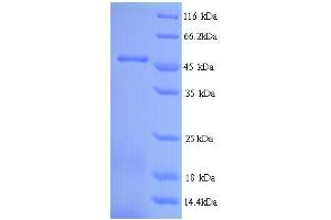 SDS-PAGE (SDS) image for Major Royal Jelly Protein 1 (MRJP1) (AA 20-432) protein (His tag) (ABIN5714288) (Major Royal Jelly Protein 1 (MRJP1) (AA 20-432) protein (His tag))