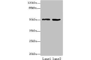 Western blot All lanes: ZBTB32 antibody at 4 μg/mL Lane 1: Mouse brain tissue Lane 2: Jurkat whole cell lysate Secondary Goat polyclonal to rabbit IgG at 1/10000 dilution Predicted band size: 53 kDa Observed band size: 53 kDa (ZBTB32 antibody  (AA 1-294))