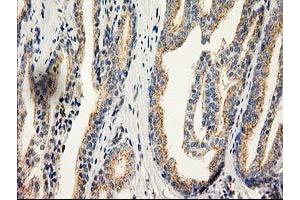Image no. 3 for anti-Catalase (CAT) antibody (ABIN1497109) (Catalase antibody)