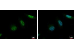 ICC/IF Image MCAK antibody [N1N3] detects MCAK protein at nucleus by immunofluorescent analysis. (KIF2C antibody)