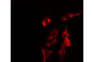 ABIN6274740 staining COLO205 by IF/ICC. (MRPL40 antibody  (C-Term))