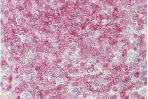 Immunohistochemistry with Spleen tissue at an antibody concentration of 5µg/ml using anti-RIPK3 antibody (AVARP00031_P050) (RIPK3 antibody  (Middle Region))