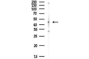 Western blot analysis of lysates from HepG2 cells(heat-shock, 45 min treatment), using RCC1 Antibody at 1/1000 dilution.