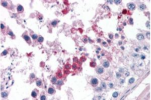 ABIN184733 (3. (Septin 3 antibody  (N-Term))