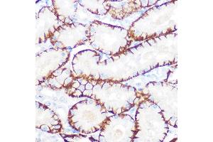 Immunohistochemistry of paraffin-embedded rat kidney using NDRG1 Rabbit mAb (ABIN7268783) at dilution of 1:100 (40x lens). (NDRG1 antibody)