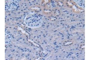 Immunohistochemistry (IHC) image for anti-Fibronectin (AA 355-558) antibody (ABIN7429001)