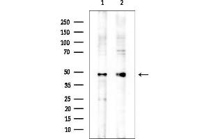 anti-Bleomycin Hydrolase (BLMH) (C-Term) antibody