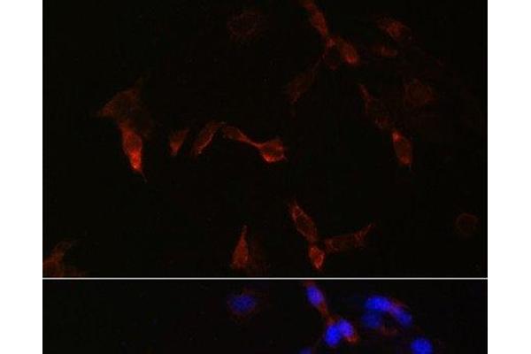 PLA2G5 antibody