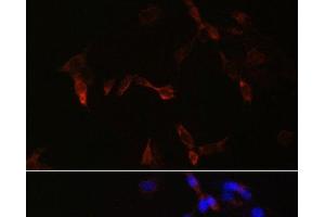 Immunofluorescence analysis of NIH/3T3 cells using PLA2G5 Polyclonal Antibody at dilution of 1:100. (PLA2G5 antibody)