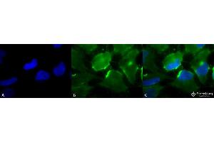 Immunocytochemistry/Immunofluorescence analysis using Mouse Anti-CD74 Monoclonal Antibody, Clone PIN 1. (CD74 antibody  (Atto 594))