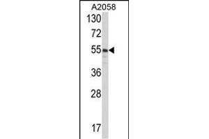 Western blot analysis of PDIA3 Antibody (C-term) (ABIN389464 and ABIN2839529) in  cell line lysates (35 μg/lane). (PDIA3 antibody  (C-Term))