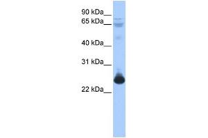 WB Suggested Anti-TCEAL1 Antibody Titration:  0. (TCEAL1 antibody  (Middle Region))