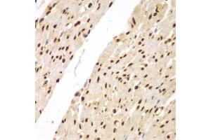 Immunohistochemistry of paraffin-embedded human colon using SUPT20H antibody (ABIN5975125) at dilution of 1/100 (40x lens).