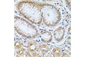 Immunohistochemistry of paraffin-embedded human stomach using CPM antibody (ABIN6128978, ABIN6138956, ABIN6138957 and ABIN6222238) at dilution of 1:100 (40x lens). (CPM antibody  (AA 204-443))