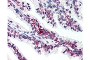 Immunohistochemistry (Formalin/PFA-fixed paraffin-embedded sections) of human prostate with SLC39A6 polyclonal antibody . (SLC39A6 antibody  (Internal Region))