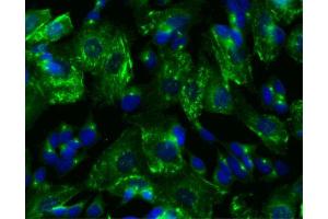 Immunofluorescent staining of SK-N-SH cells. (PRKAR2B antibody  (pSer114))