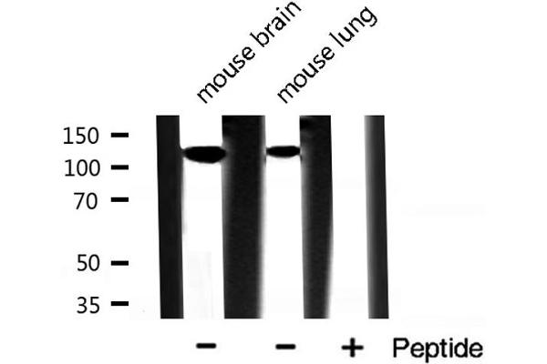 INPP5D antibody  (C-Term)