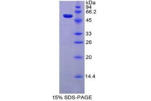 SDS-PAGE (SDS) image for Trefoil Factor 3 (Intestinal) (TFF3) (AA 22-80) protein (His tag,GST tag) (ABIN2123802) (TFF3 Protein (AA 22-80) (His tag,GST tag))