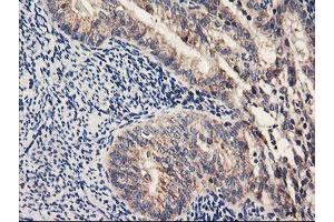 Image no. 1 for anti-Prenyl (Decaprenyl) Diphosphate Synthase, Subunit 2 (PDSS2) antibody (ABIN1500138) (PDSS2 antibody)