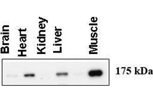 Image no. 1 for anti-Amylo-alpha-1, 6-Glucosidase, 4-alpha-Glucanotransferase (AGL) (AA 1487-1516), (C-Term) antibody (ABIN357688) (AGL antibody  (C-Term))
