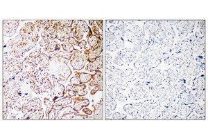 Immunohistochemistry (IHC) image for anti-Coiled-Coil Domain Containing 102B (CCDC102B) (Internal Region) antibody (ABIN1851142) (CCDC102B antibody  (Internal Region))
